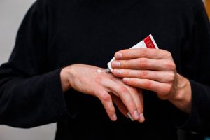 Read more about Beneficial Tips for Dealing with Psoriasis