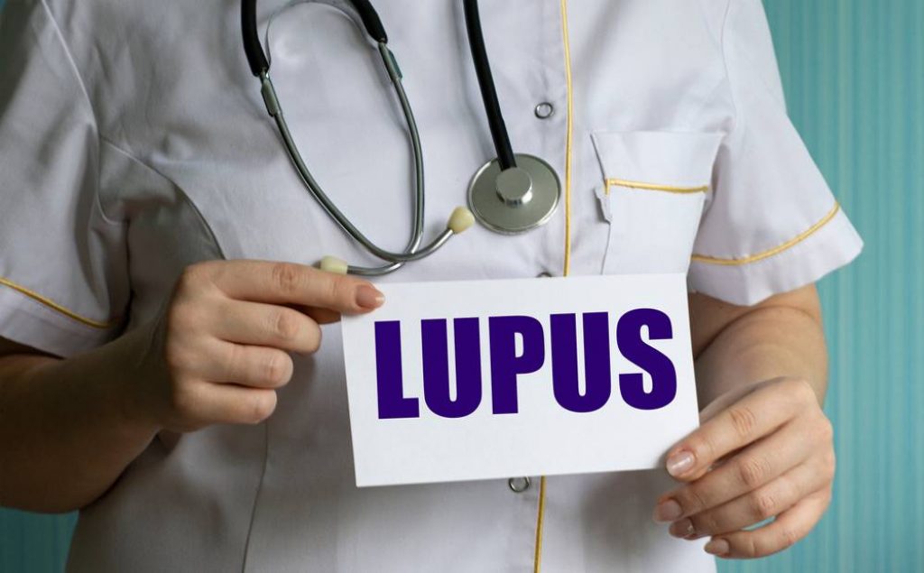 Lupus