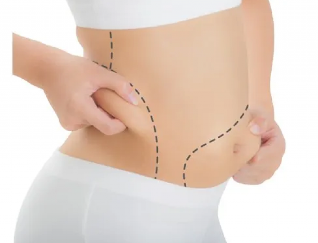 Best Coolsculpting Solutions In Georgia