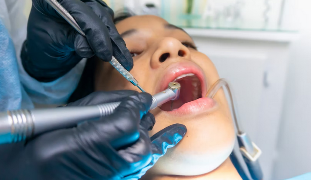 5 Best Dental Implant Dentists In North Carolina