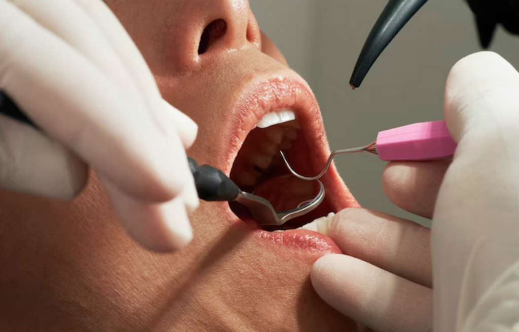 5 Best Dental Implant Dentists in Ohio