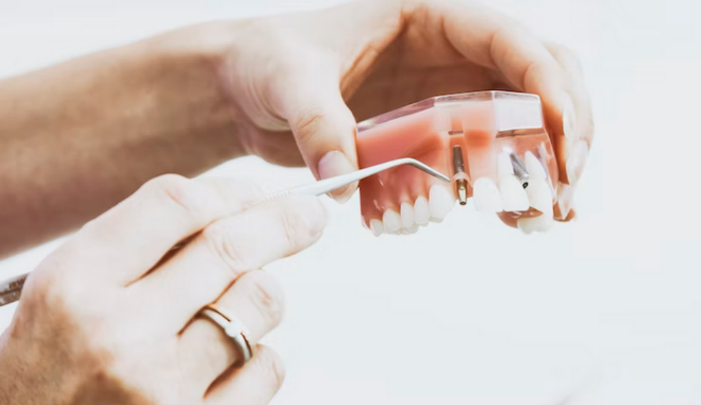 Best Dental Implant Dentists in Pennsylvania