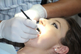 7 Best Dental Implant Options In California