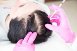 Best Hair Loss Treatments for Women