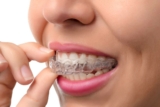 Costs, Benefits and Medicare Coverage For Invisalign