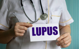Foods That Can Increase The Risk Of Lupus