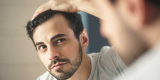 Best Way To Treat Hair Loss For Men